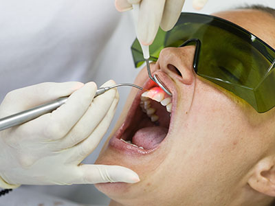 Palmdale Dental Group | Periodontal Treatment, Sports Mouthguards and E4D
